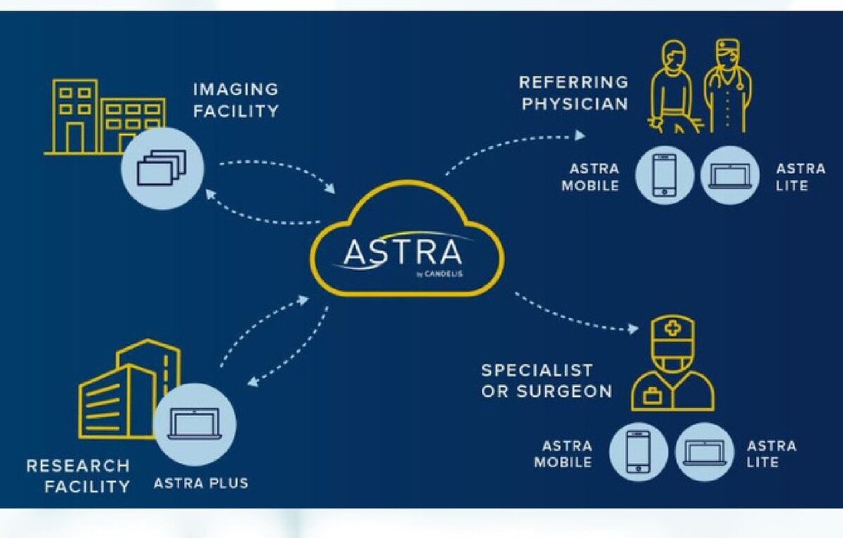 Candelis Astra Cloud Storage